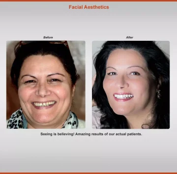 2018-aesthetics-case-2