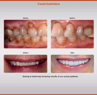 2018-aesthetics-case-4