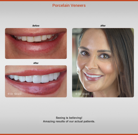 before-after-amanda-gallery