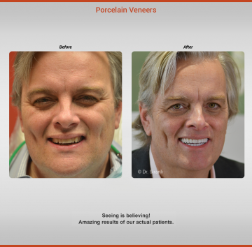 before-after-dabney-gallery